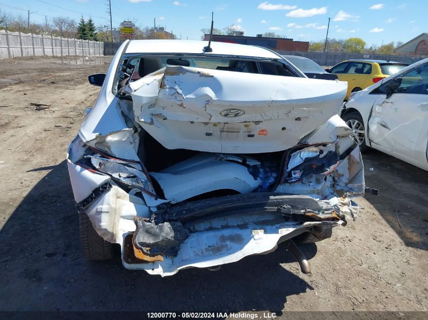 2017 Hyundai Accent Se VIN: KMHCT4AE3HU303134 Lot: 12000770