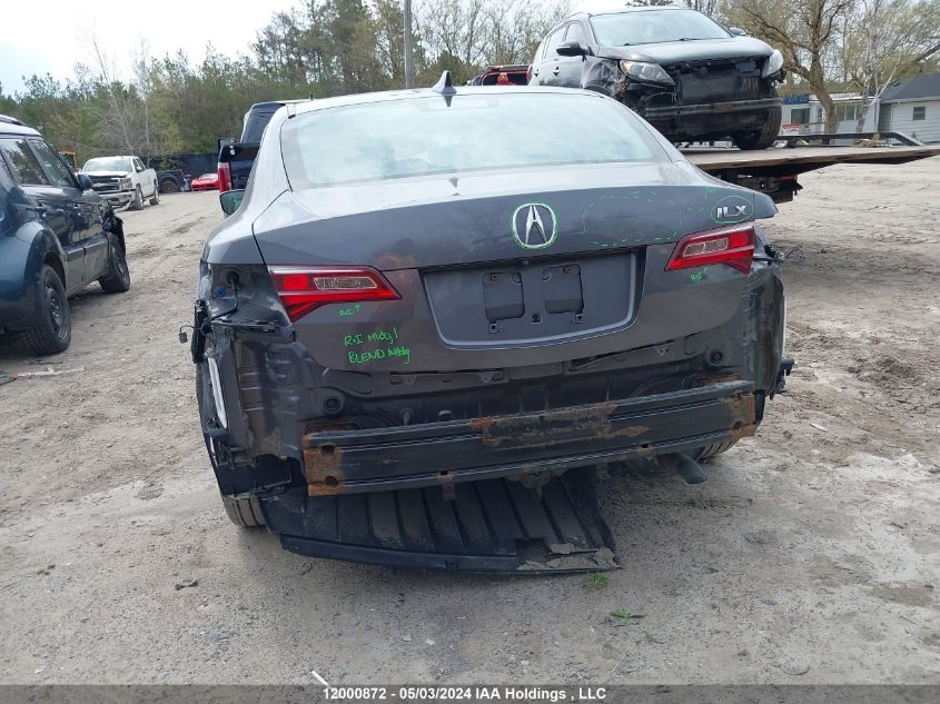 2017 Acura Ilx VIN: 19UDE2F71HA803149 Lot: 12000872