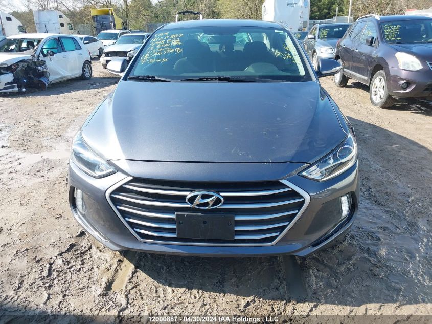 2018 Hyundai Elantra Sel/Value/Limited VIN: KMHD84LF1JU448822 Lot: 12000887