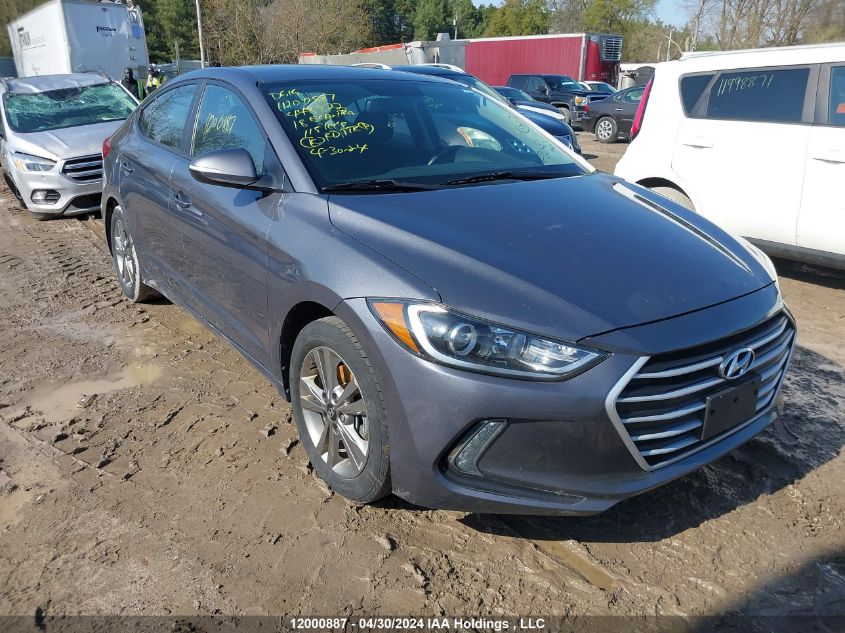 2018 Hyundai Elantra Sel/Value/Limited VIN: KMHD84LF1JU448822 Lot: 12000887