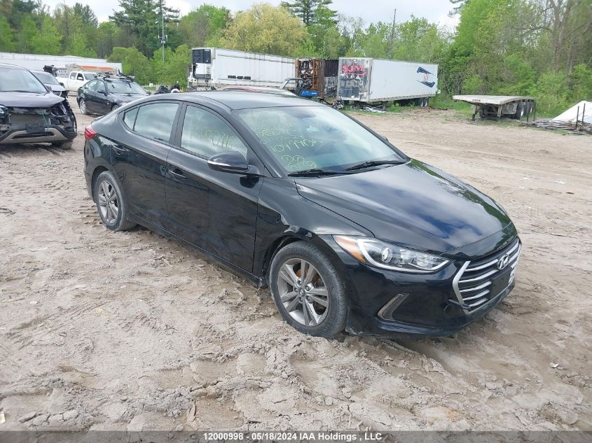 2017 Hyundai Elantra Se/Value/Limited VIN: KMHD84LF5HU324336 Lot: 12000998