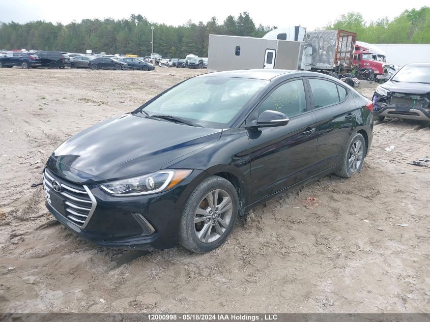 2017 Hyundai Elantra Se/Value/Limited VIN: KMHD84LF5HU324336 Lot: 12000998