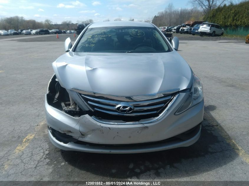 2014 Hyundai Sonata Gl VIN: 5NPEB4AC6EH911024 Lot: 12001552