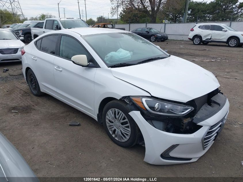 2017 Hyundai Elantra Gl VIN: KMHD84LF4HU093543 Lot: 12001642