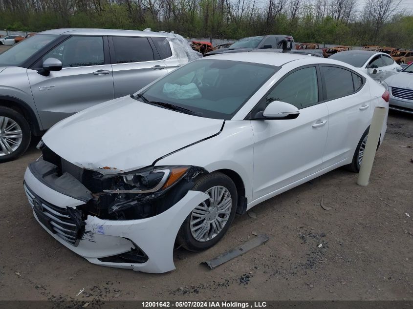 2017 Hyundai Elantra Gl VIN: KMHD84LF4HU093543 Lot: 12001642