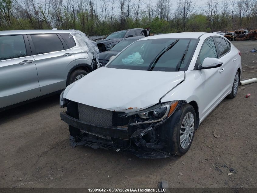 2017 Hyundai Elantra Gl VIN: KMHD84LF4HU093543 Lot: 12001642