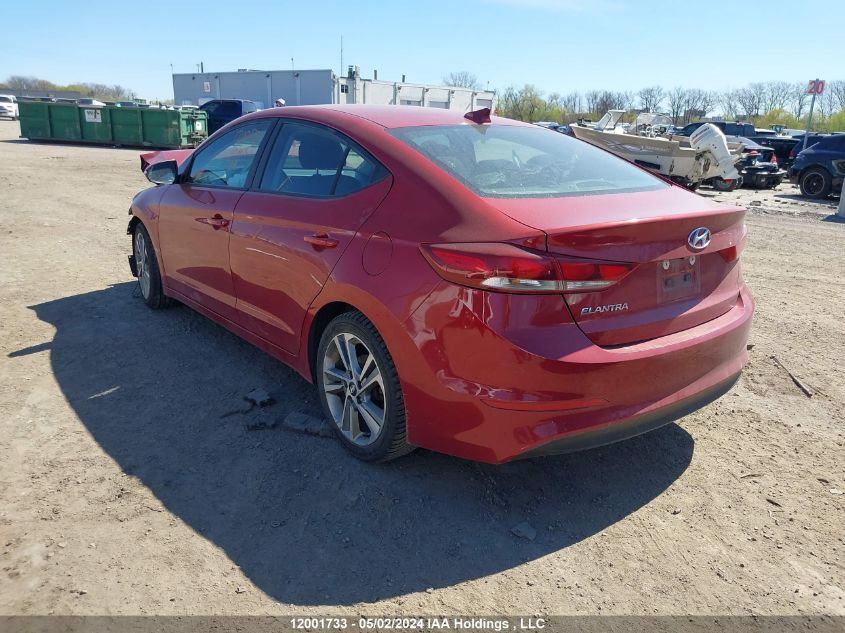 2017 Hyundai Elantra Gls VIN: KMHD84LF3HU131344 Lot: 12001733