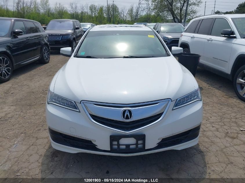 2016 Acura Tlx VIN: 19UUB3F58GA802138 Lot: 12001903