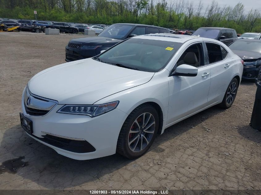 2016 Acura Tlx VIN: 19UUB3F58GA802138 Lot: 12001903