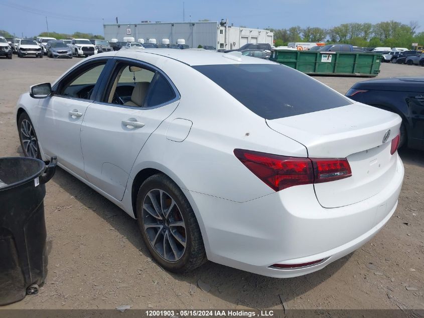 2016 Acura Tlx VIN: 19UUB3F58GA802138 Lot: 12001903