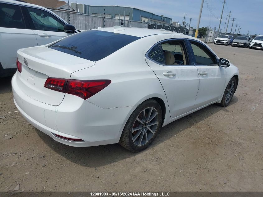 2016 Acura Tlx VIN: 19UUB3F58GA802138 Lot: 12001903