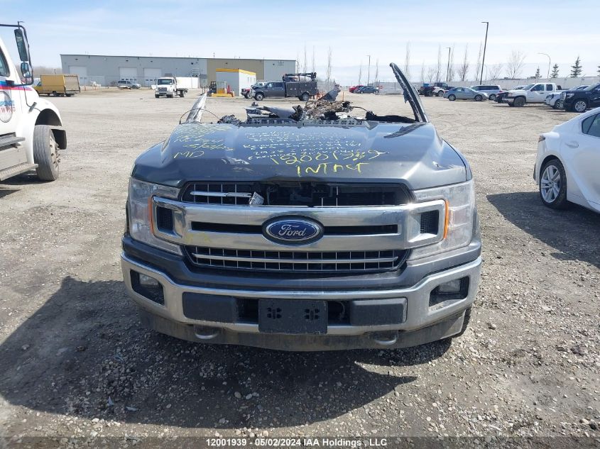 2018 Ford F150 Supercrew VIN: 1FTEW1EP8JFD46246 Lot: 12001939