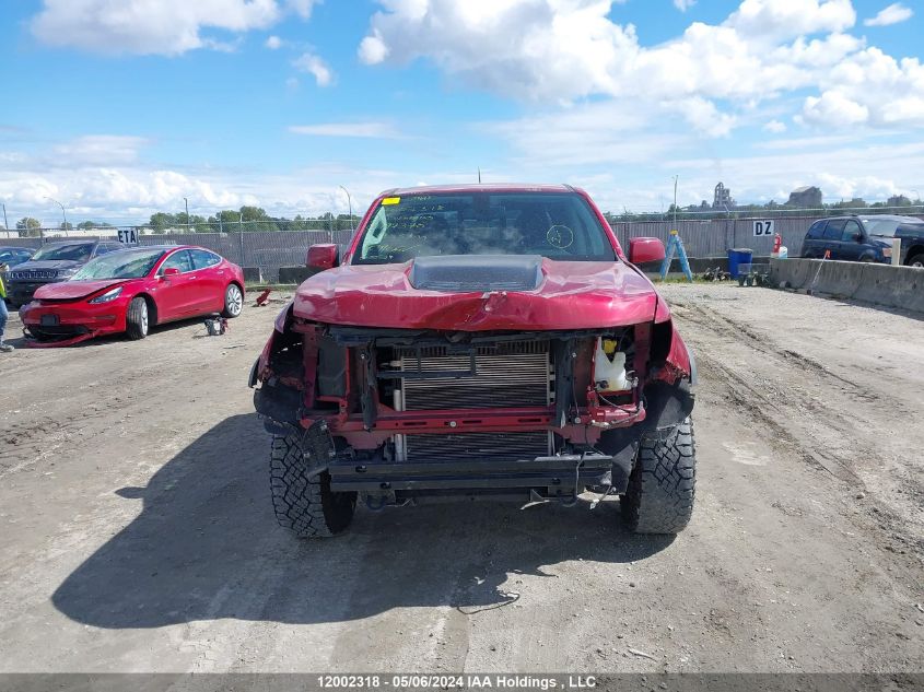 2020 Chevrolet Colorado VIN: 1GCGTEEN9L1197370 Lot: 12002318