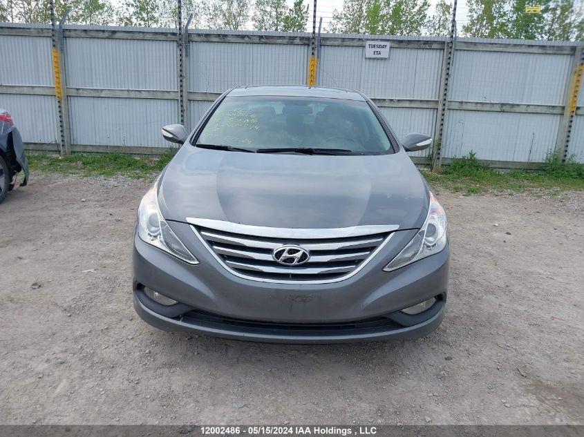 2014 Hyundai Sonata Gls VIN: 5NPEB4AC2EH904894 Lot: 12002486