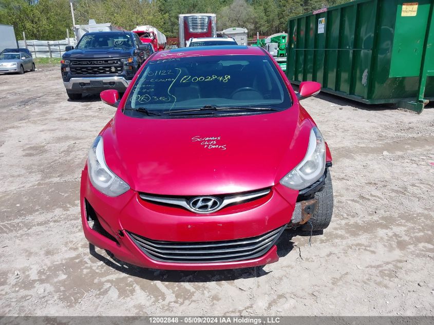 2014 Hyundai Elantra Limited VIN: KMHDH4AH8EU151122 Lot: 12002848