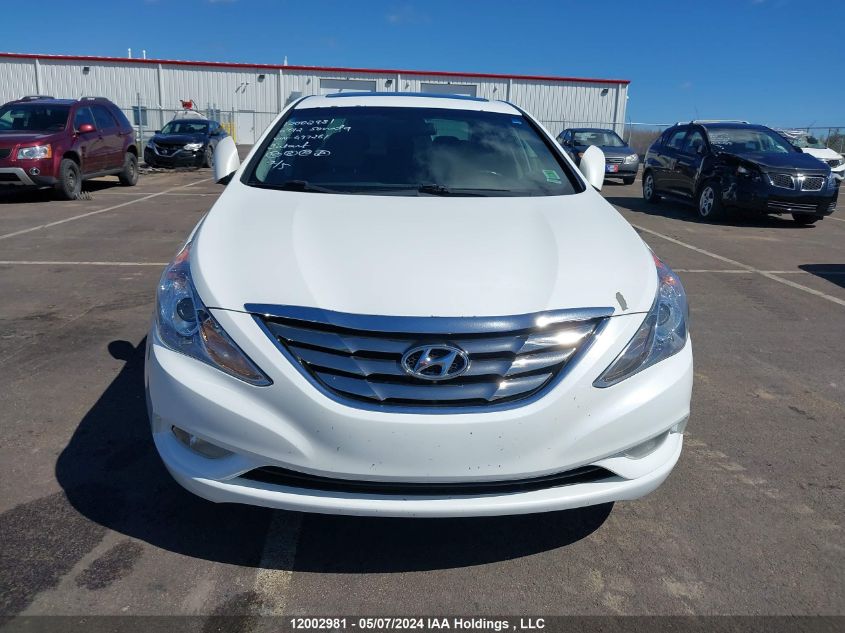 2012 Hyundai Sonata Gls VIN: 5NPEB4AC0CH477261 Lot: 12002981