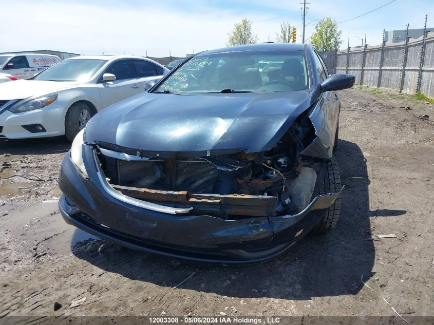 2013 Hyundai Sonata Gls VIN: 5NPEB4AC2DH757037 Lot: 12003308