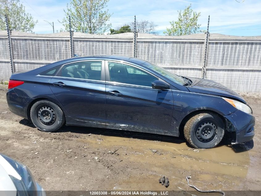 2013 Hyundai Sonata Gls VIN: 5NPEB4AC2DH757037 Lot: 12003308