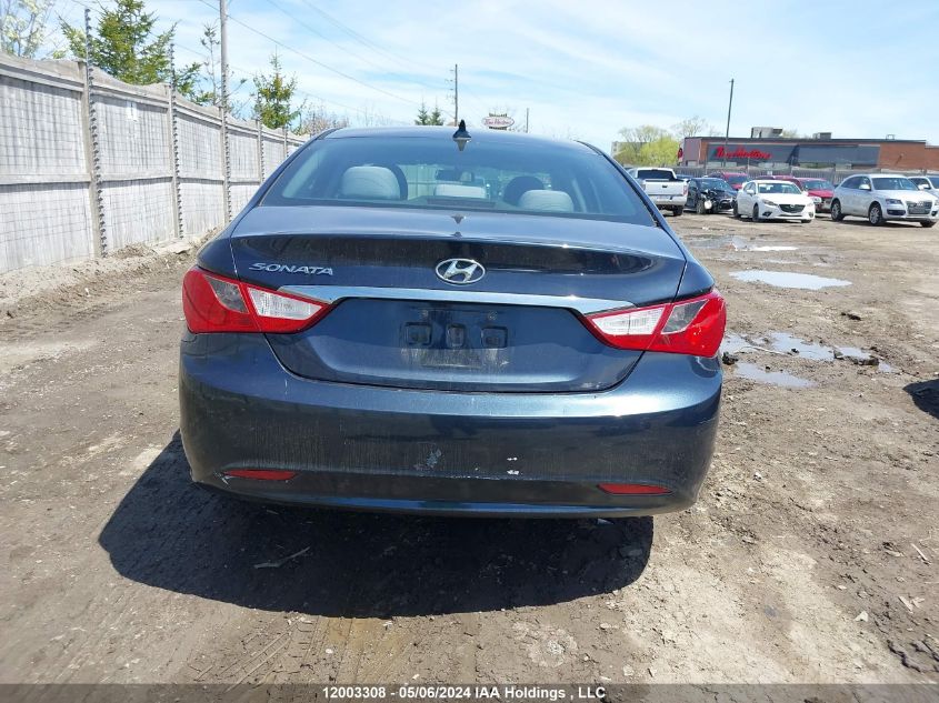 2013 Hyundai Sonata Gls VIN: 5NPEB4AC2DH757037 Lot: 12003308