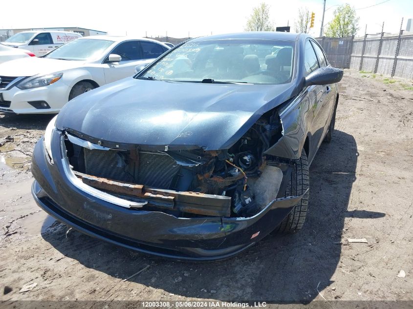 2013 Hyundai Sonata Gls VIN: 5NPEB4AC2DH757037 Lot: 12003308