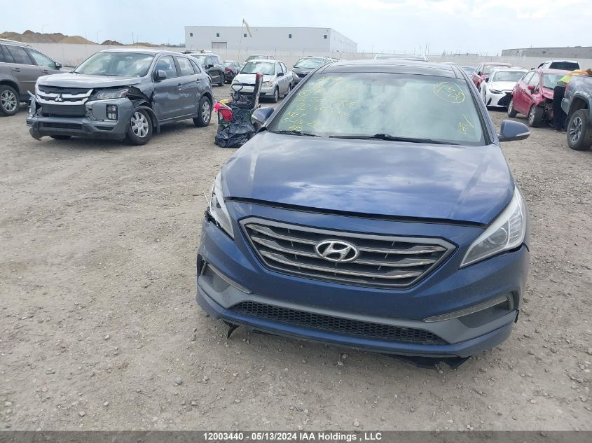 2015 Hyundai Sonata Sport/Limited VIN: 5NPE34AF6FH156000 Lot: 12003440