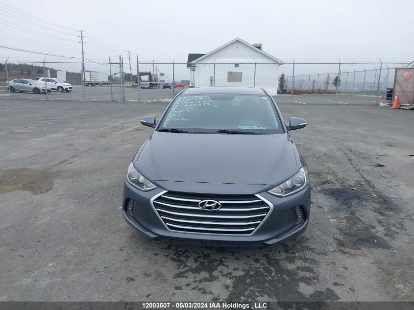 KMHD84LF6HU328492 2017 Hyundai Elantra Se/Value/Limited