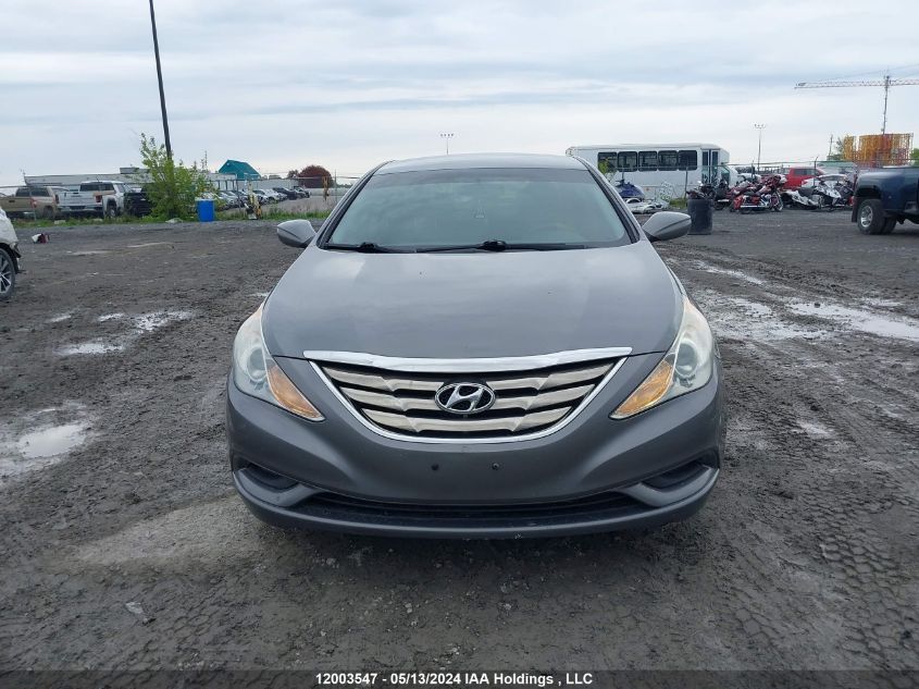 2013 Hyundai Sonata VIN: 5NPEB4AC9DH559023 Lot: 12003547