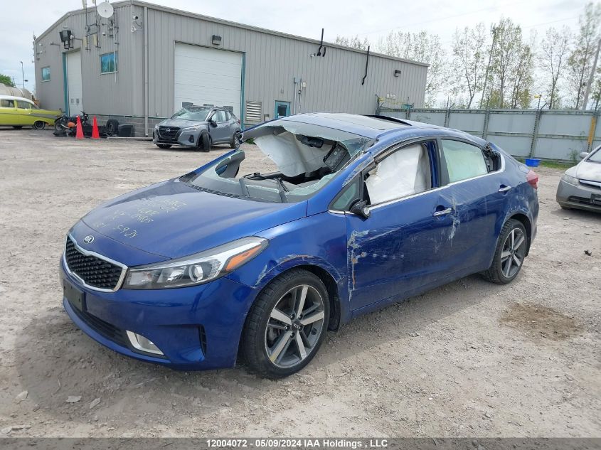 2017 Kia Forte VIN: 3KPFL4A84HE124885 Lot: 12004072