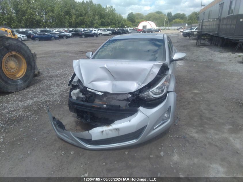 2016 Hyundai Elantra Sport Appearance VIN: KMHDH4AE5GU643986 Lot: 12004165