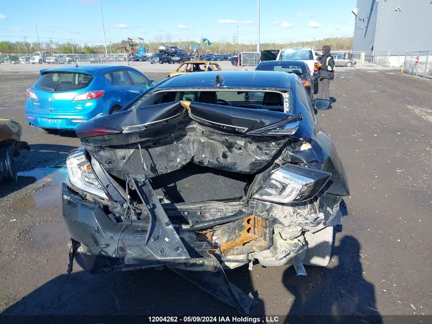 2018 Honda Civic Sedan VIN: 2HGFC1F91JH106937 Lot: 12004262