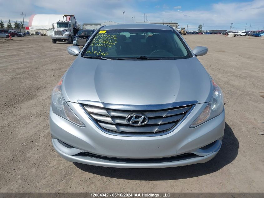 2013 Hyundai Sonata Gls VIN: 5NPEB4AC1DH753223 Lot: 12004342