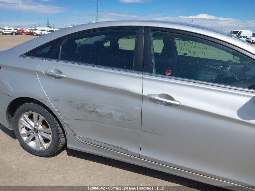 2013 Hyundai Sonata Gls VIN: 5NPEB4AC1DH753223 Lot: 12004342