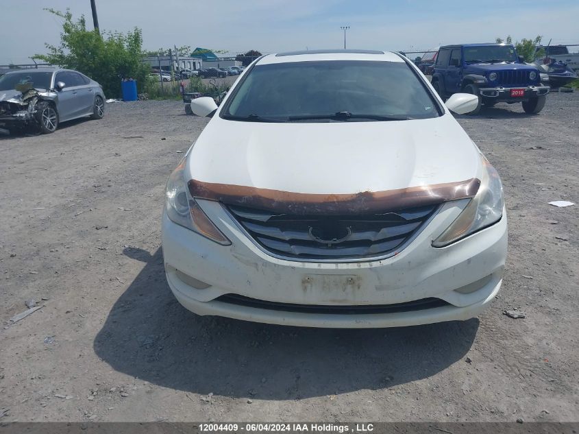 2013 Hyundai Sonata Se VIN: 5NPEC4AC8DH514412 Lot: 12004409