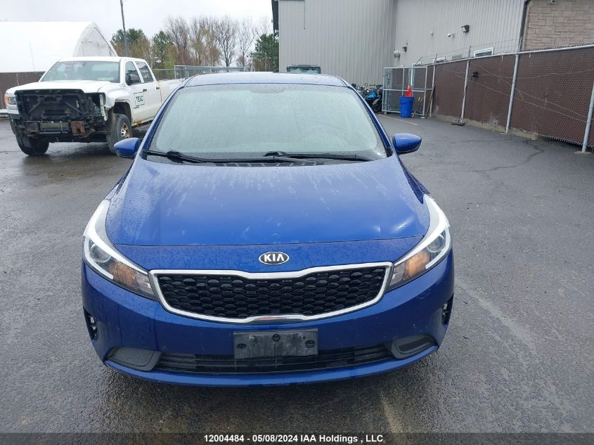 2018 Kia Forte VIN: 3KPFK4A78JE216291 Lot: 12004484