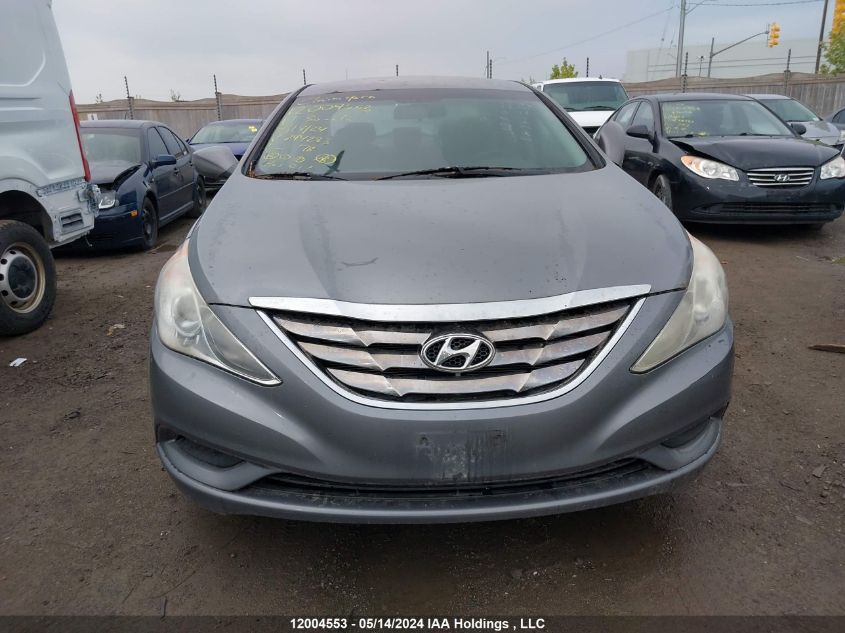 2011 Hyundai Sonata Gls VIN: 5NPEB4AC9BH244283 Lot: 12004553