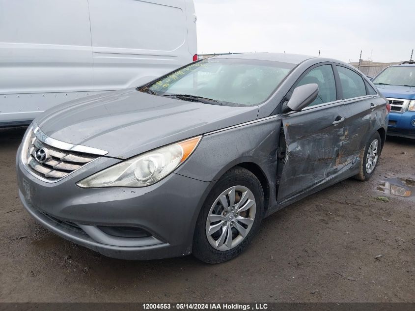 2011 Hyundai Sonata Gls VIN: 5NPEB4AC9BH244283 Lot: 12004553