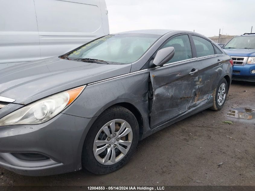 2011 Hyundai Sonata Gls VIN: 5NPEB4AC9BH244283 Lot: 12004553