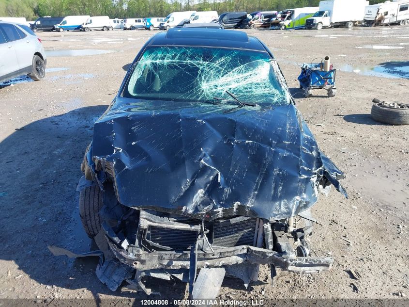 2010 BMW 3 Series VIN: WBAPG7C56AA794604 Lot: 12004808