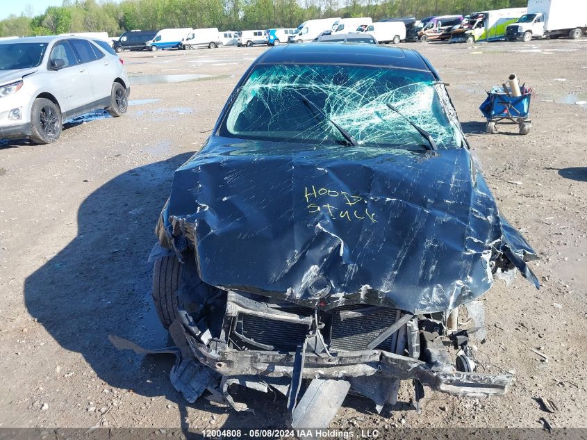 2010 BMW 3 Series VIN: WBAPG7C56AA794604 Lot: 12004808