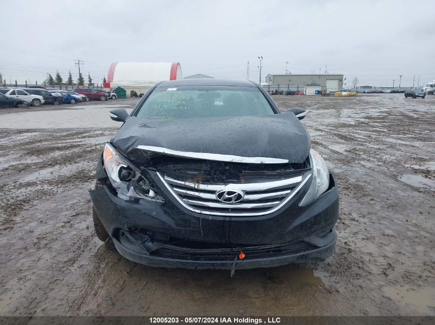 2014 Hyundai Sonata Gls VIN: 5NPEB4AC5EH896175 Lot: 12005203