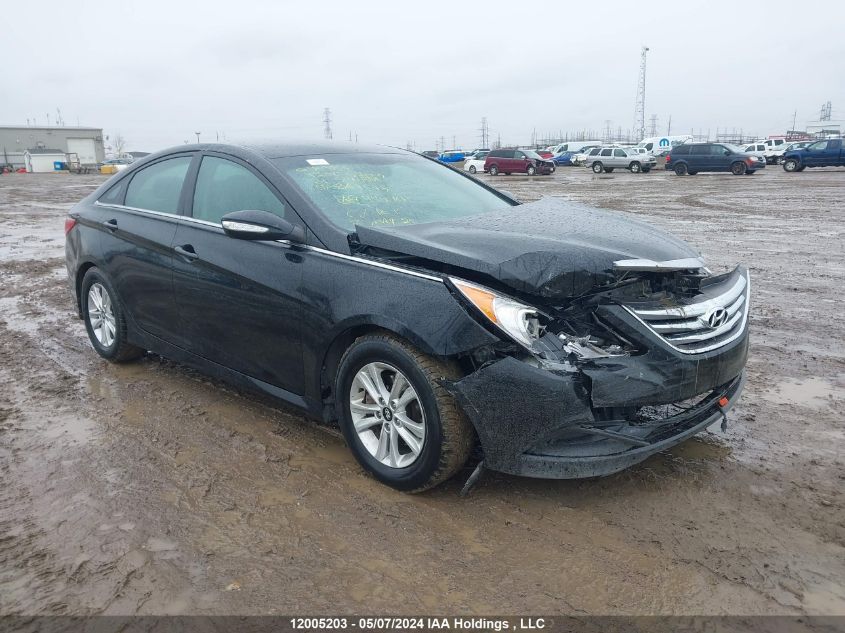 2014 Hyundai Sonata Gls VIN: 5NPEB4AC5EH896175 Lot: 12005203