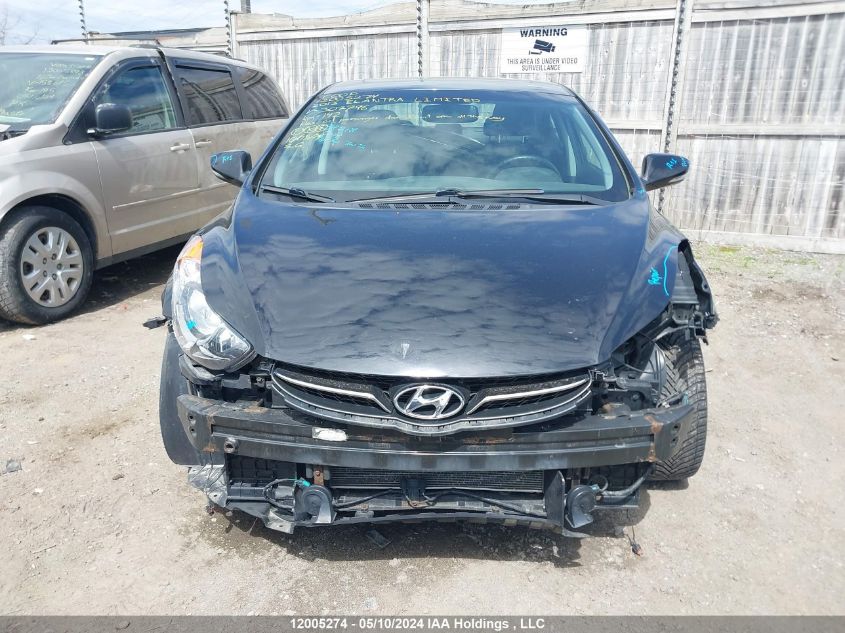 2013 Hyundai Elantra Limited VIN: 5NPDH4AE5DH307796 Lot: 12005274