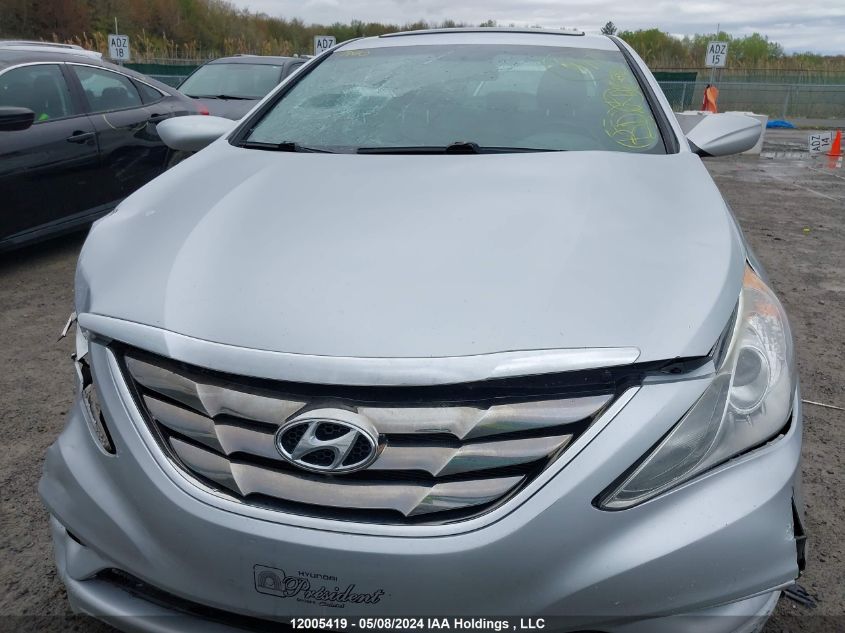 2012 Hyundai Sonata Gls VIN: 5NPEB4AC4CH334457 Lot: 12005419