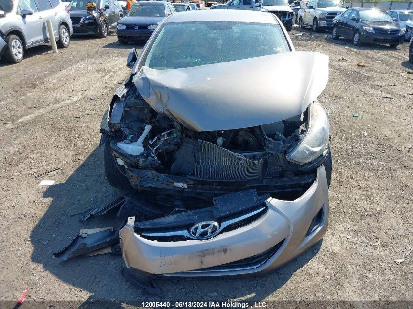 2013 Hyundai Elantra Gl VIN: 5NPDH4AE0DH302683 Lot: 12005440