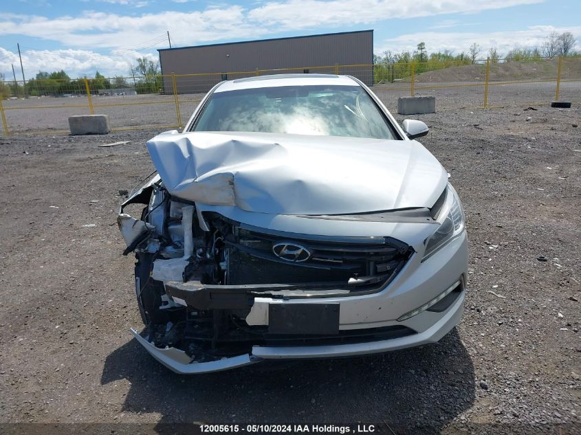 2017 Hyundai Sonata Gls VIN: 5NPE24AF4HH440361 Lot: 12005615