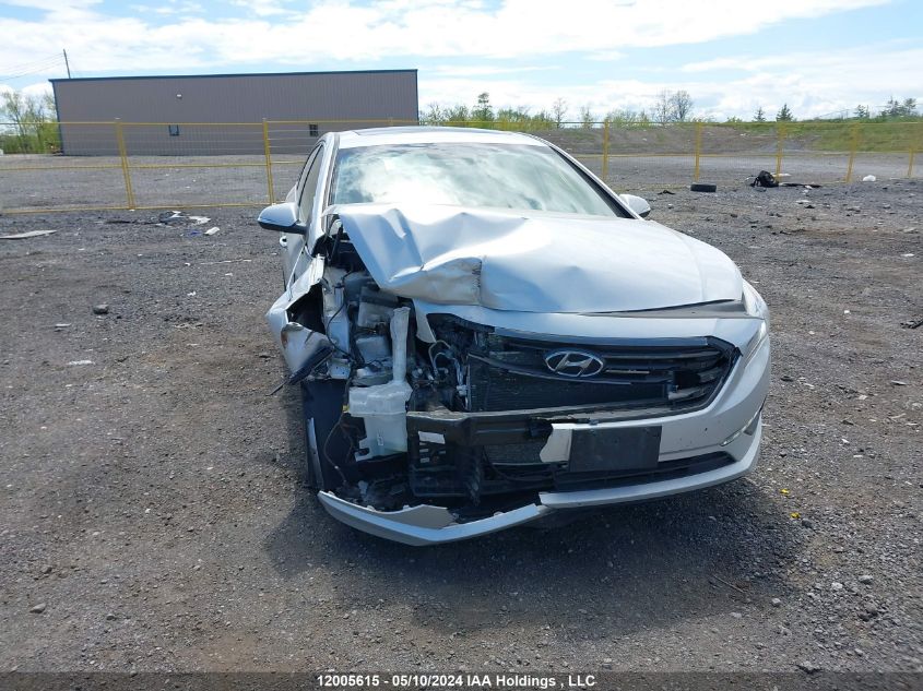 2017 Hyundai Sonata Gls VIN: 5NPE24AF4HH440361 Lot: 12005615