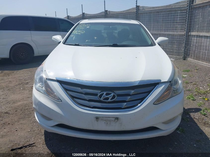 2011 Hyundai Sonata Gls VIN: 5NPEB4AC7BH215347 Lot: 12005636