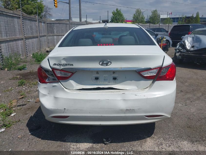 2011 Hyundai Sonata Gls VIN: 5NPEB4AC7BH215347 Lot: 12005636