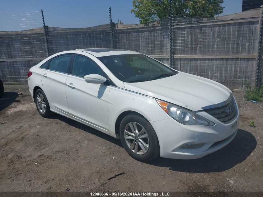 2011 Hyundai Sonata Gls VIN: 5NPEB4AC7BH215347 Lot: 12005636