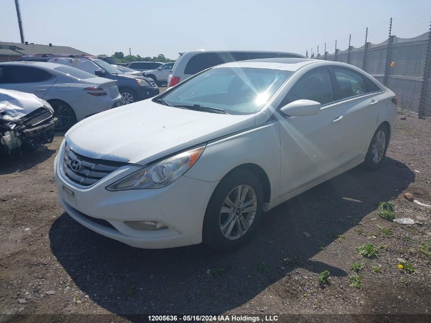 2011 Hyundai Sonata Gls VIN: 5NPEB4AC7BH215347 Lot: 12005636